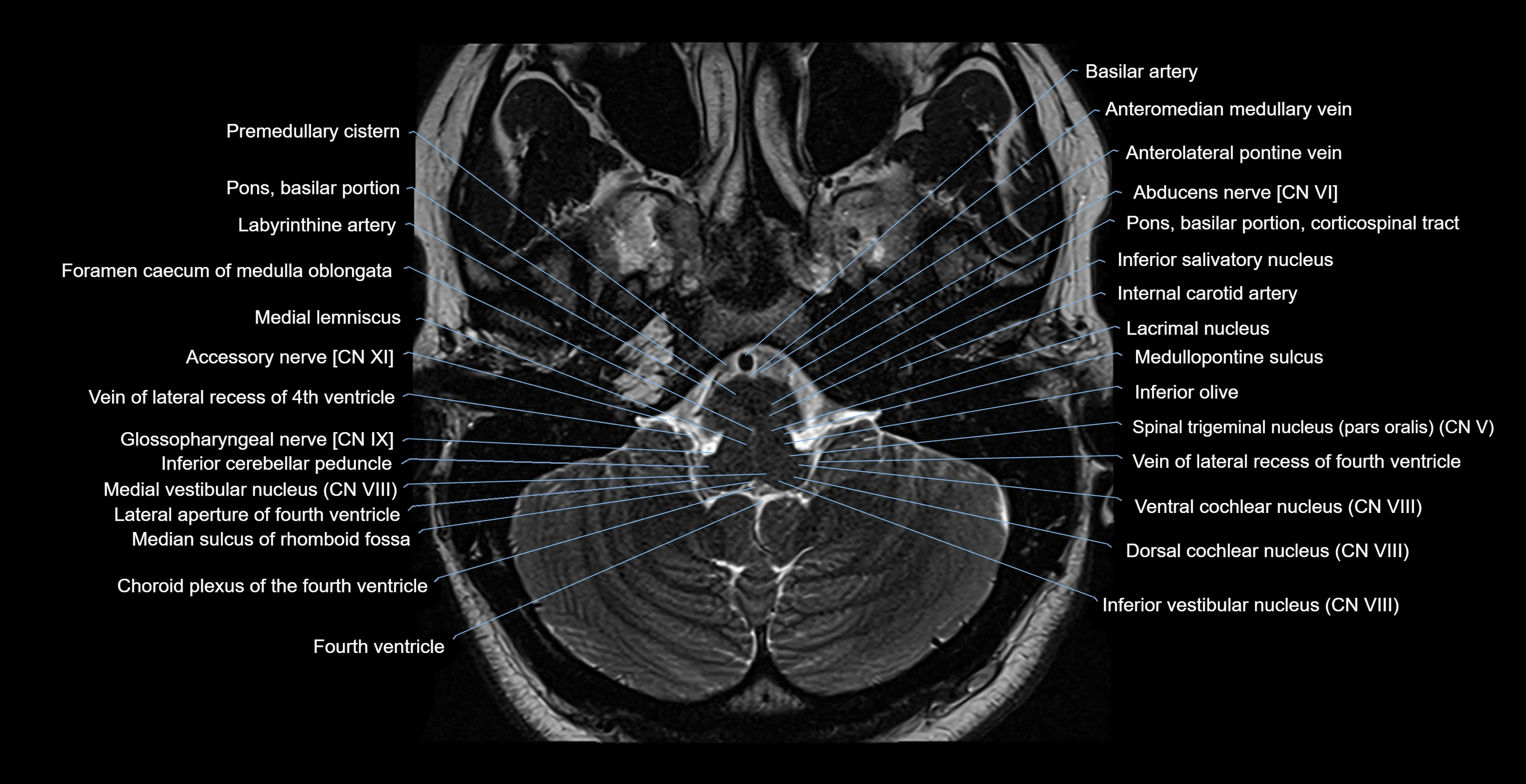 brain axial anatomy 3T MRI images -img-17001-00009.webp